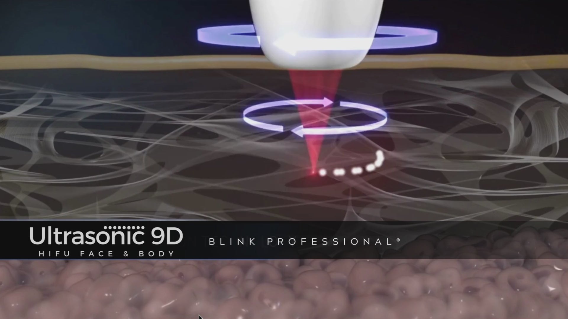 Ultrasonic 9D (Nuevo)